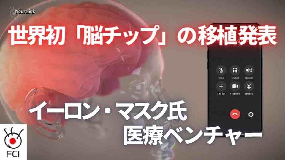 世界初「脳チップ」の移植発表　イーロン・マスク氏医療ベンチャー
